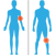 Body Chart & Color Coding