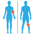 Body Chart & Color Coding