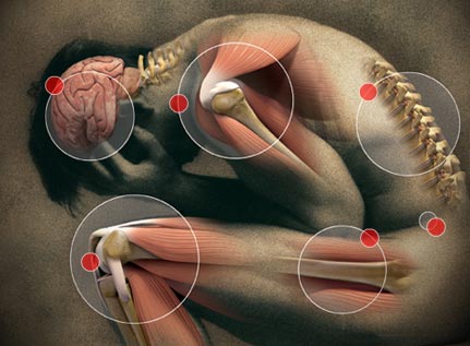 New IMA device could improve diagnosis, treatment of chronic musculoskeletal pain